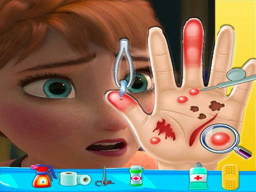 Play Anna frozen Hand Doctor: Fun Games for Girls Onlin