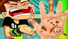 Ben10 Hand Doctor - Free Online Game